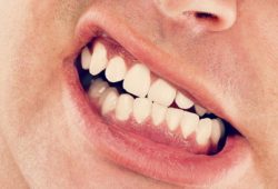Kauno miesto dantu implantavimas